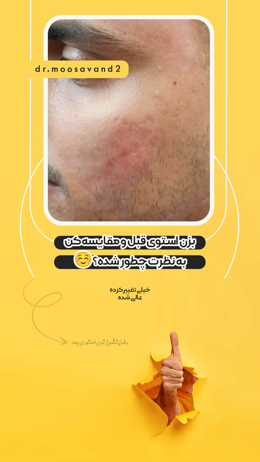 Story-design-technique-portfolio-(3)